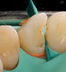 POZA 3 CAZ1 1000X1092